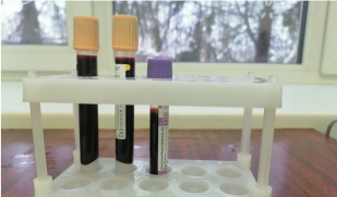 С 2026 года в Самарской области вводят обязательную проверку мигрантов на гепатит